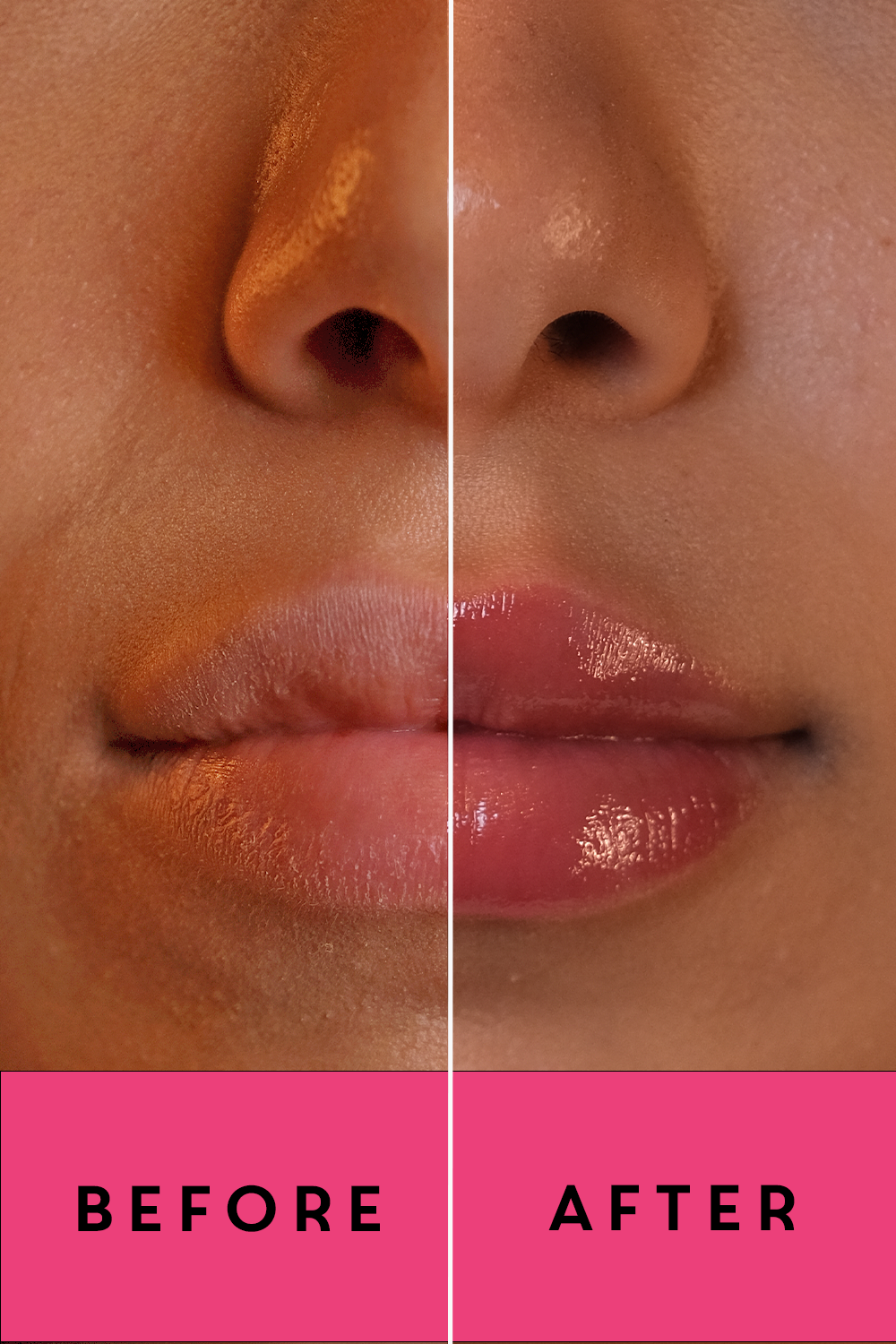 Parabelle™ Lip Plumper